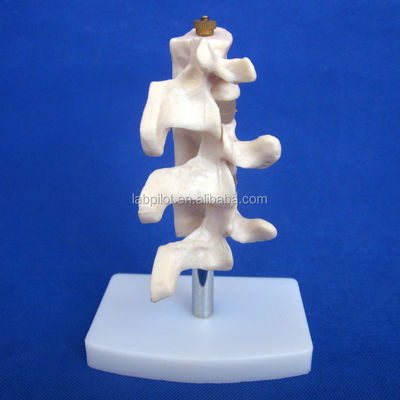 Erweiterte PVC-Bildungsmodelle Abtrennung Osteoporose der Wirbelsäule Läsionen des Lendenwirbels