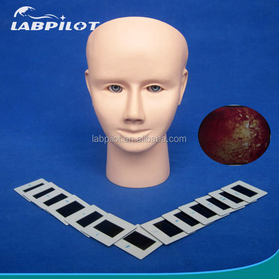Mannequin für die Weiterbildung der menschlichen Augenuntersuchung Simulator Retinopathie Fundus Modell
