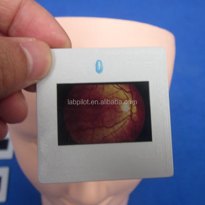 Mannequin für die Weiterbildung der menschlichen Augenuntersuchung Simulator Retinopathie Fundus Modell