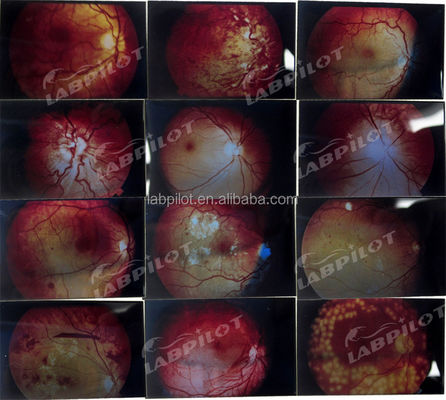 Mannequin für die Weiterbildung der menschlichen Augenuntersuchung Simulator Retinopathie Fundus Modell