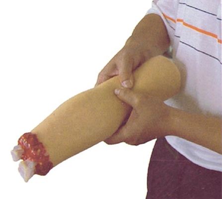 Modell für Trauma-Krankenpflege Armamputation und Hämostase für die Wundbehandlung der oberen Gliedmaßen