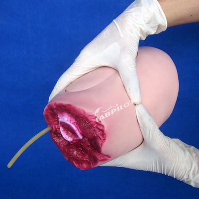 Advanced PVC-Modell Die ideale Lösung für Unterglieder-Trauma-Oberschenkel-Amputation Pflege