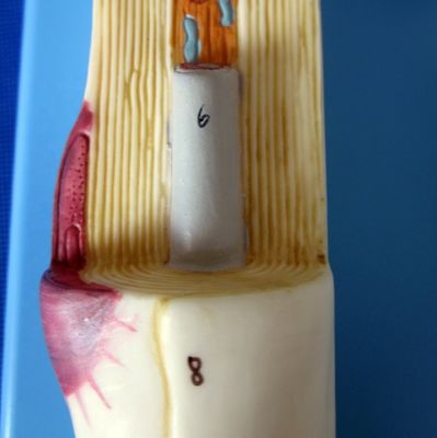 Erweiterte PVC-Anatomische Modell des vergrößerten neuronalen Zellkörpers und der Nervenfaserstruktur