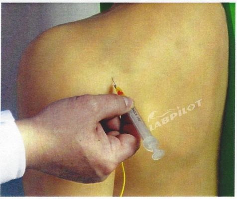 Erweiterte PVC-Medizinische Ausbildung Schultergelenk Intracavitary Injektion Simulator Lehrmodell