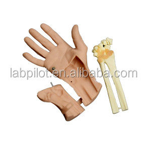 Vorteilhaftes Modell der Arthroskopie des Handgelenks für die anatomische Struktur des Handgelenks