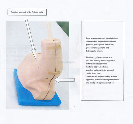 Vivid Schultergelenk-Anatomie-Trainingsmodell mit abnehmbarem Schulterarthroskopie-Simulator