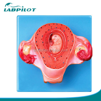 Erweitertes PVC-Uterusmodell für den zweiten Schwangerschaftsmonat Anatomische Uterusdemonstration