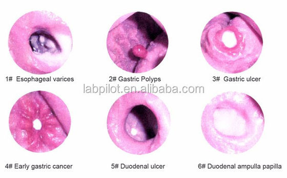 Fortgeschrittene Gastroskopische Untersuchung und ERCP-Ausbildungsmodell für Magen-Darm-Läsionen