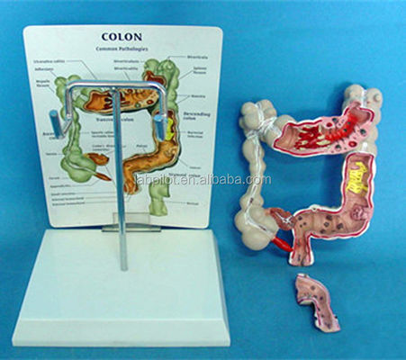Ophthalmologische anatomische Modelle Modell des menschlichen Darms für Darm- und Rektumerkrankungen