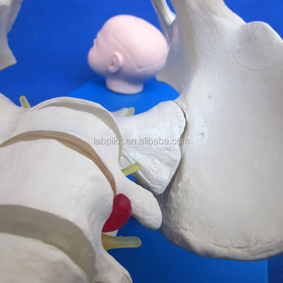 Vivid Pelvis und Fötusköpfe Erweitertes PVC-Modell zur Demonstration von Geburtsfähigkeiten