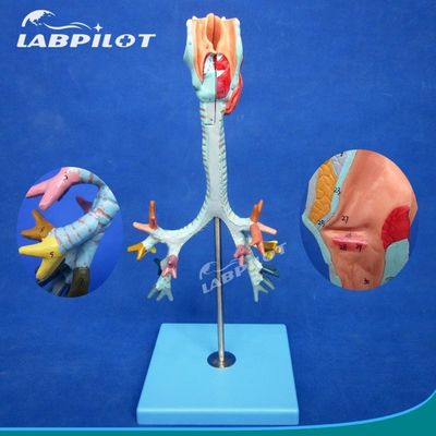 Medizinische Wissenschaft Anzeige Trennbarer Bronchialbaum und Trachea Modell für Larynx Anatomie