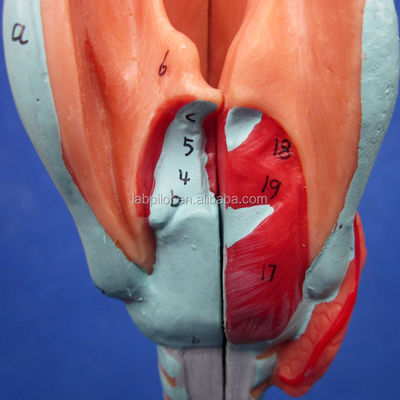Medizinische Wissenschaft Anzeige Trennbarer Bronchialbaum und Trachea Modell für Larynx Anatomie