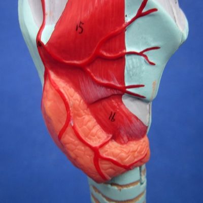 Medizinische Wissenschaft Anzeige Trennbarer Bronchialbaum und Trachea Modell für Larynx Anatomie