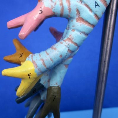 Medizinische Wissenschaft Anzeige Trennbarer Bronchialbaum und Trachea Modell für Larynx Anatomie