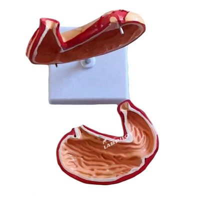 Erweitertes PVC-Medizinisches Lehrmodell für Krankenhäuser Human Magen Anatomisches Modell