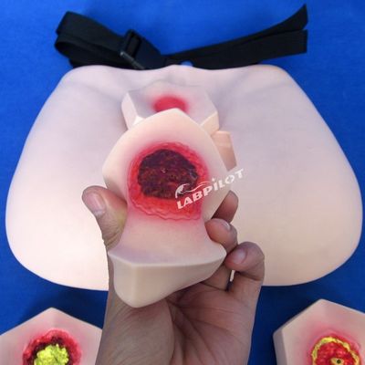 Patientenversorgung Demonstration Druckwunden Pflege Modell Stufe Schlafwunden Lehrmodell