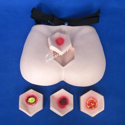 Patientenversorgung Demonstration Druckwunden Pflege Modell Stufe Schlafwunden Lehrmodell