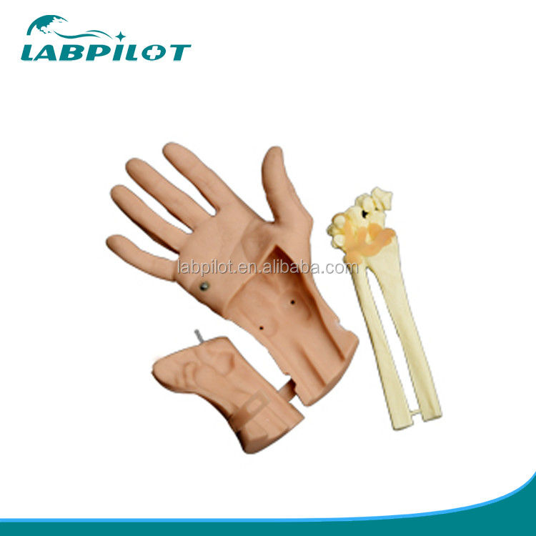 Vorteilhaftes Modell der Arthroskopie des Handgelenks für die anatomische Struktur des Handgelenks