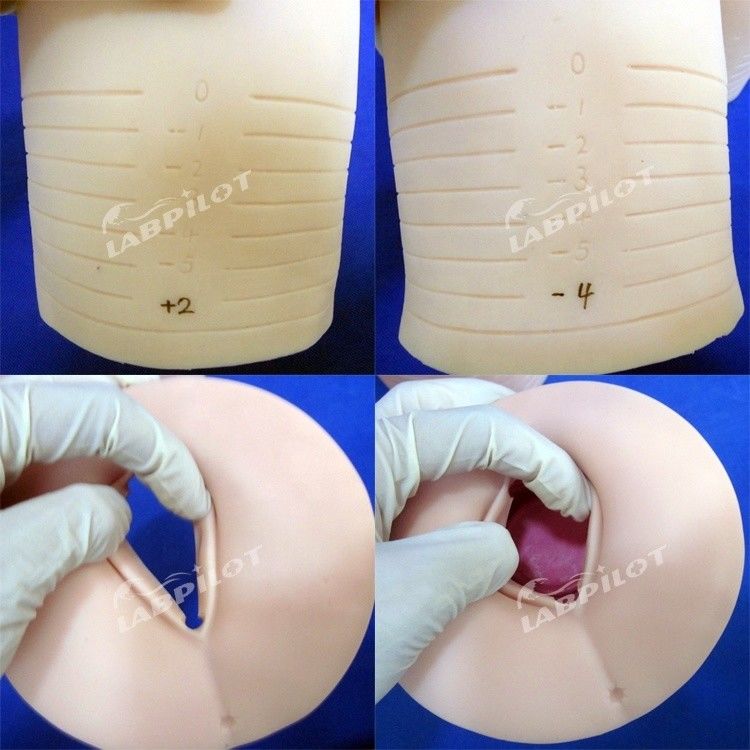 Modell für Geburtshilfe und Gynäkologie Zervixdilatation und Verwischung Simulator